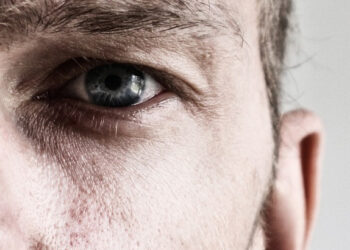 Ste nespokojní so svojim telom?