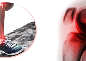 Benefity kĺbovej výživy sa ukazujú byť zveličené