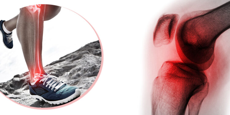 Benefity kĺbovej výživy sa ukazujú byť zveličené