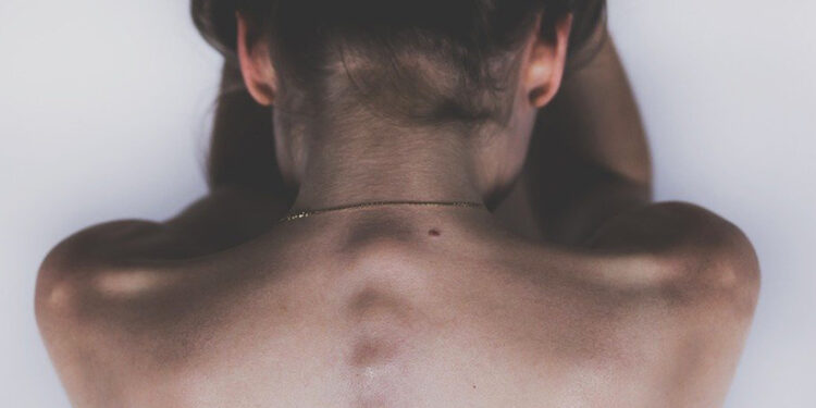 Pandémia kruto zasiahla aj ženskú sexualitu